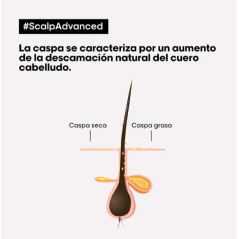 L'OREAL SERIE EXPERT - SCALP ADVANCED CHAMPU ANTI-CASPA 300 ML